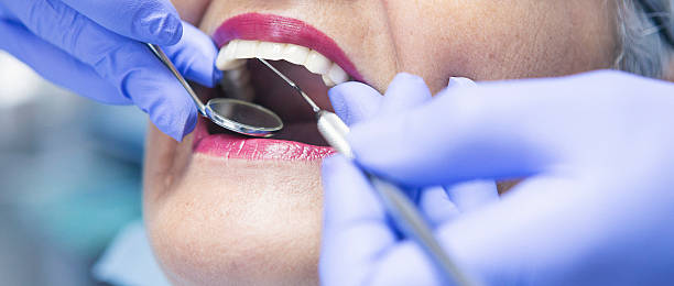 Best After-Hours Emergency Dentist in Brentwood, MO
